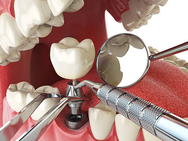 Best Cracked Tooth Emergency Dentist  in Burns Harbor, IN